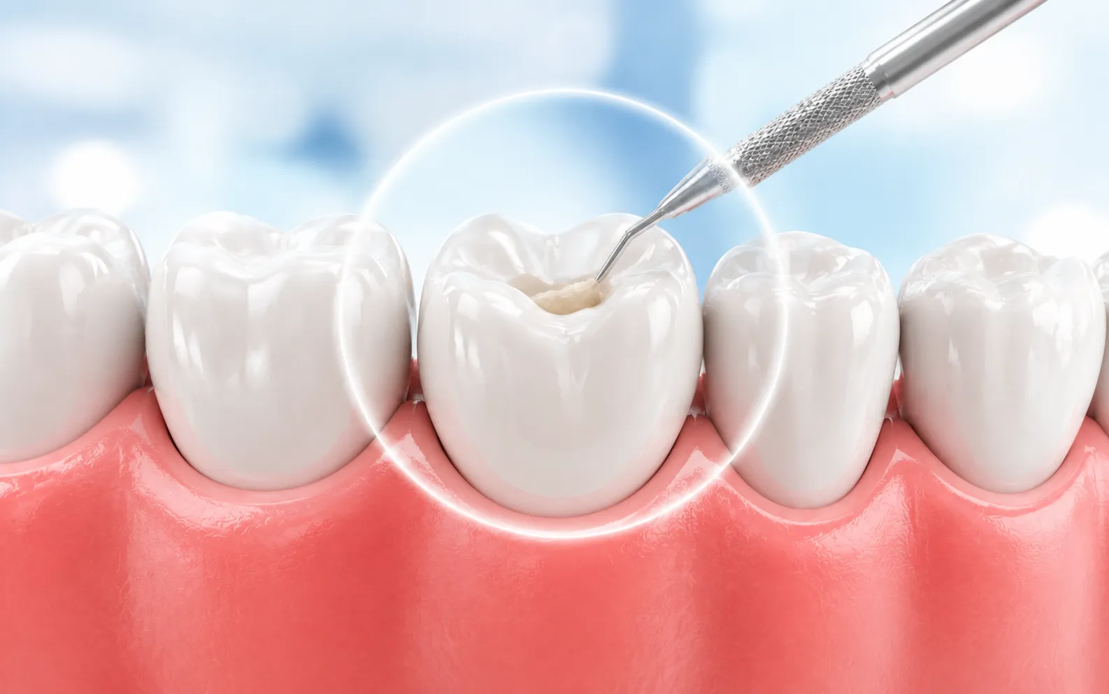 Conservative Dental Procedures: Why Less Is More When It Comes to Your Natural Teeth