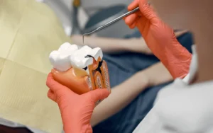 Replacement Procedures